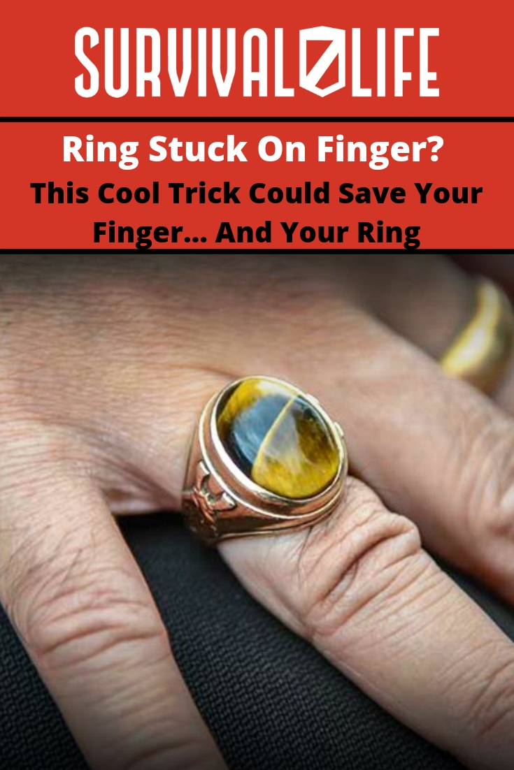 Ring Stuck On Finger? This Trick Could Save Your Finger And Your Ring 